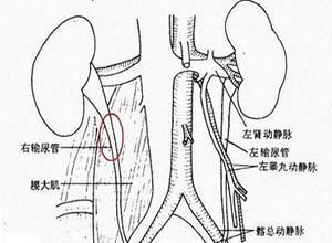 泌尿道肿瘤皮肤转移