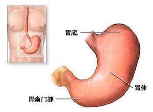 贲门黏膜撕裂综合征