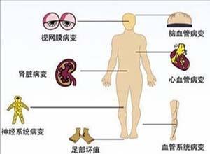 槭糖尿病