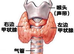 妊娠合并甲状腺功能亢进