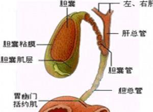 胆道张力低下综合征