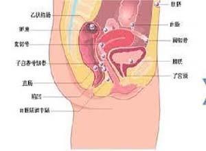 生殖道肿瘤