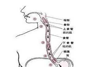 食管穿透性损伤