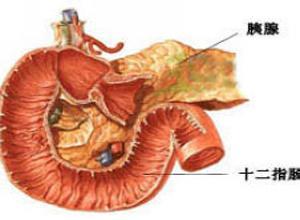 儿童胰腺功能不全并中性粒细胞减少症综合征