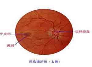 小儿Alstrom综合征