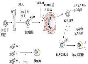 小儿X-连锁无丙种球蛋白血症