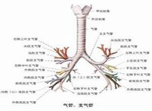 小儿急性气管支气管炎