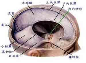 小儿颅内出血