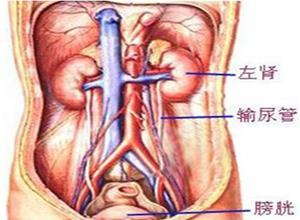 小儿尿路梗阻