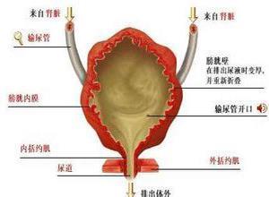 小儿神经源性膀胱