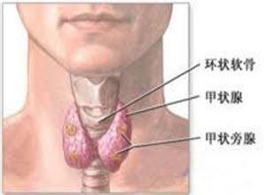 小儿先天性甲状腺功能减低症