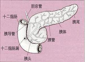 胰腺囊性纤维性变