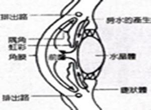 正常眼压性青光眼