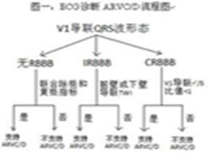 致心律失常性右室心肌病