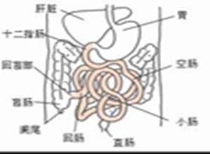 转移性小肠肿瘤