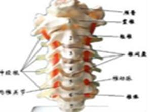 椎动脉型颈椎病