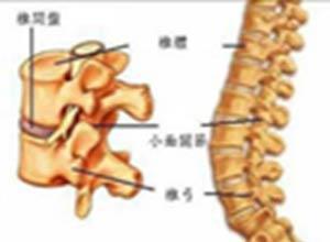 椎间盘钙化症