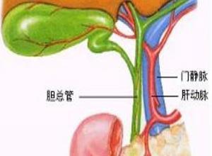 浓缩胆汁综合征