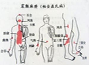颤证