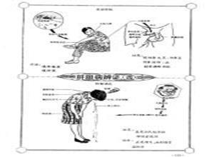 寒滞肝脉证