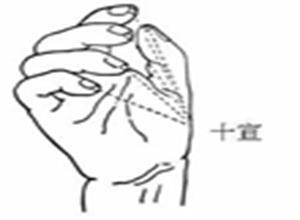 筋痹