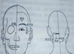 蟹睛