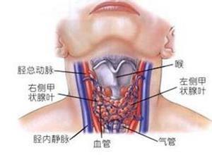 甲状腺结节