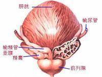 急性细菌性前列腺炎