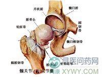 儿童股骨头坏死