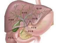淤胆型肝炎