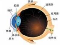 玻璃体液化