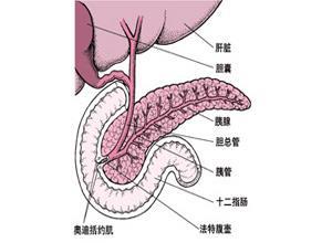 小儿急性胰腺炎