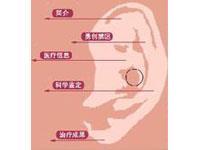 伪聋