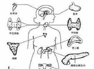 席汉氏综合症