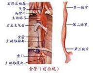 食管狭窄