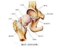 成人先天性髋关节脱位