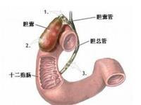 萎缩性胆囊炎