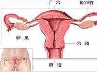 混合型阴道炎