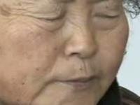 梅杰综合症