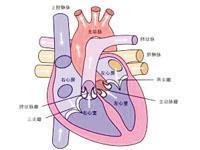 心脏瓣膜关闭不全