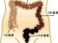 便秘性结肠炎