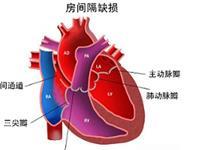 心脑血管疾病