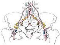 腹股沟淋巴结炎