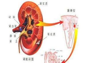 小儿原发性肾病综合征