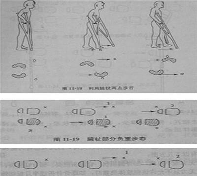 拐杖的使用方法