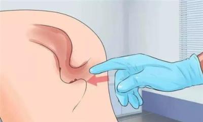 警惕！天津欧亚肛肠医院提醒不要回避和轻视便血问题！