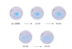 逆时光雕刻,玻尿酸黑科技——玻菲玻尿酸